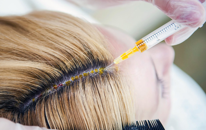 Мезотерапия волос: что это такое и в каких случаях стоит применять